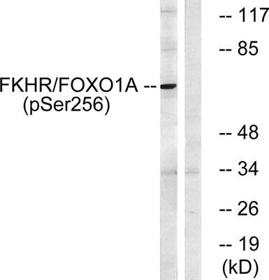 FoxO1 (phospho Ser256) Rabbit Polyclonal Antibody | 兔多抗 | EnkiLife恩玑生命