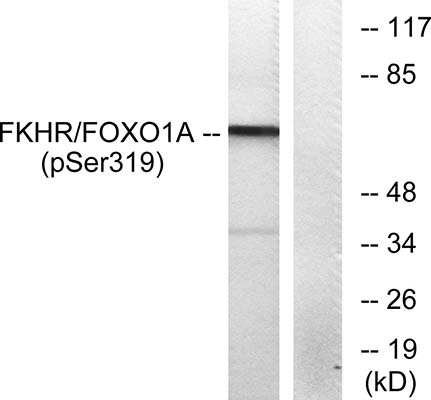 FoxO1 (phospho Ser319) Rabbit Polyclonal Antibody | 兔多抗 | EnkiLife恩玑生命