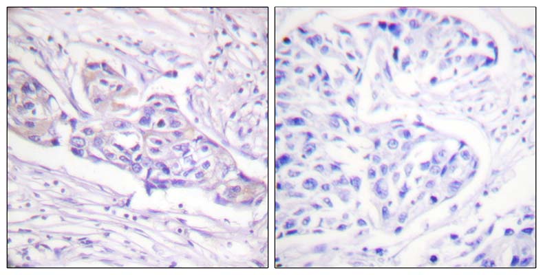 FoxO1A (phospho Ser329) Rabbit Polyclonal Antibody | 兔多抗 | EnkiLife恩玑生命