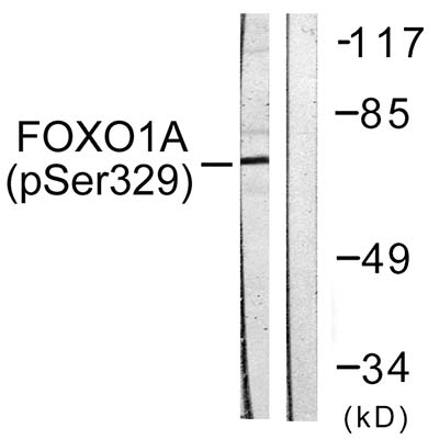 FoxO1A (phospho Ser329) Rabbit Polyclonal Antibody | 兔多抗 | EnkiLife恩玑生命