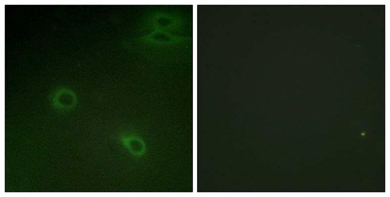 Fusin (phospho Ser339) Rabbit Polyclonal Antibody | 兔多抗 | EnkiLife恩玑生命