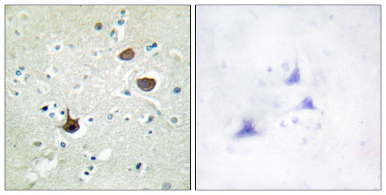 Fusin (phospho Ser339) Rabbit Polyclonal Antibody | 兔多抗 | EnkiLife恩玑生命
