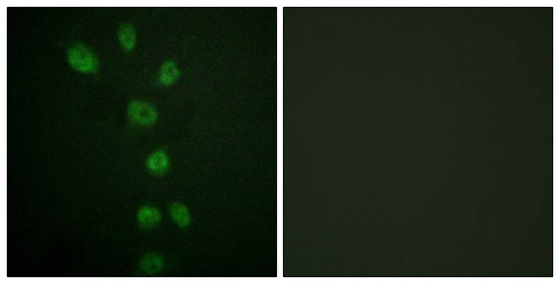 GATA-4 (phospho Ser105) Rabbit Polyclonal Antibody | 兔多抗 | EnkiLife恩玑生命