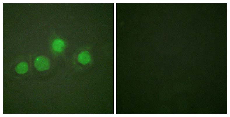 GATA-4 (phospho Ser262) Rabbit Polyclonal Antibody | 兔多抗 | EnkiLife恩玑生命