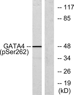 GATA-4 (phospho Ser262) Rabbit Polyclonal Antibody | 兔多抗 | EnkiLife恩玑生命
