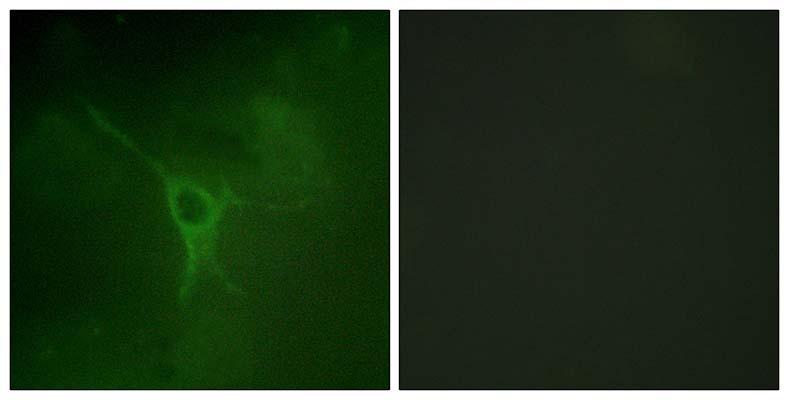 GFAP (phospho Ser38) Rabbit Polyclonal Antibody | 兔多抗 | EnkiLife恩玑生命