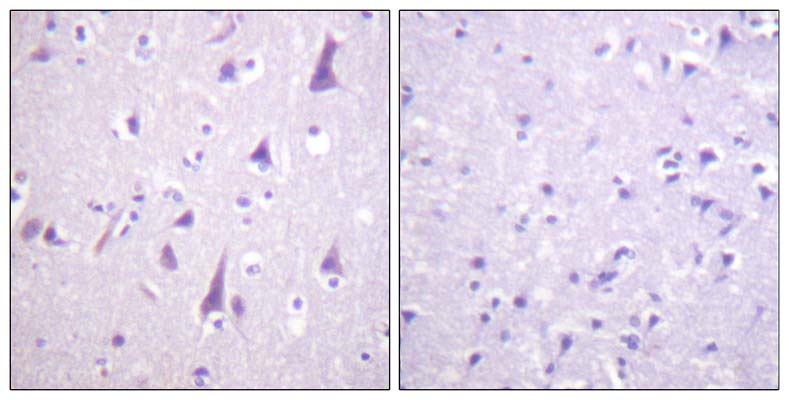 GFAP (phospho Ser38) Rabbit Polyclonal Antibody | 兔多抗 | EnkiLife恩玑生命