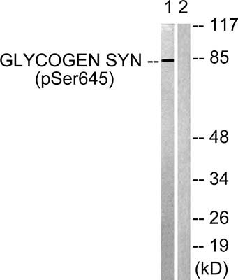 Glycogen Synthase 1 (phospho Ser645) Rabbit Polyclonal Antibody | 兔多抗 | EnkiLife恩玑生命