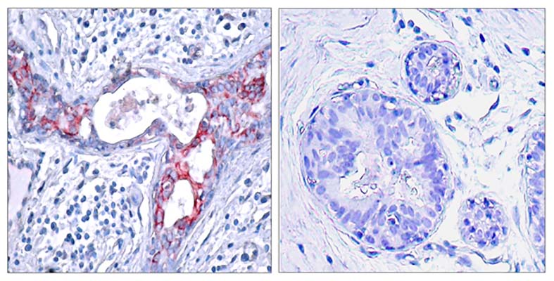 GSK3β (phospho Ser9) Rabbit Polyclonal Antibody | 兔多抗 | EnkiLife恩玑生命