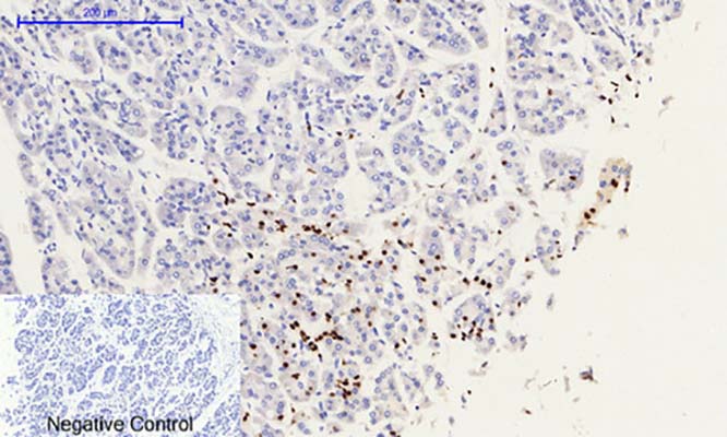 Histone H2A.X (phospho Ser139) Rabbit Polyclonal Antibody | 兔多抗 | EnkiLife恩玑生命