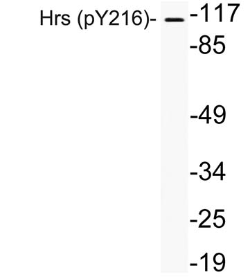 Hrs (phospho Tyr216) Rabbit Polyclonal Antibody | 兔多抗 | EnkiLife恩玑生命