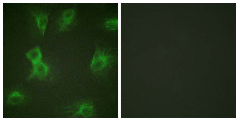 Hrs (phospho Tyr334) Rabbit Polyclonal Antibody | 兔多抗 | EnkiLife恩玑生命