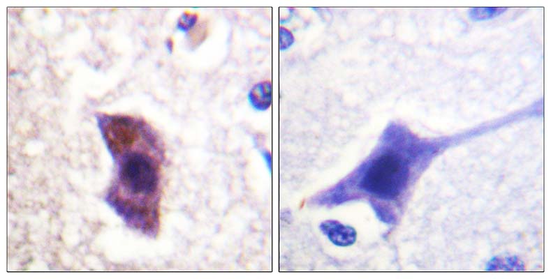 Hrs (phospho Tyr334) Rabbit Polyclonal Antibody | 兔多抗 | EnkiLife恩玑生命