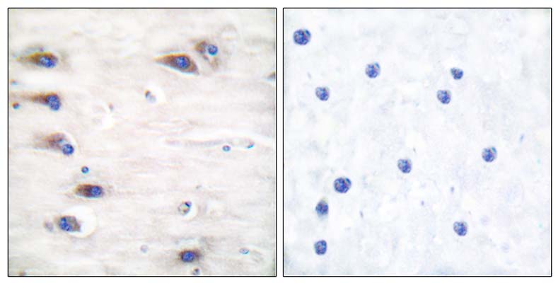 Ksr-1 (phospho Ser392) Rabbit Polyclonal Antibody | 兔多抗 | EnkiLife恩玑生命