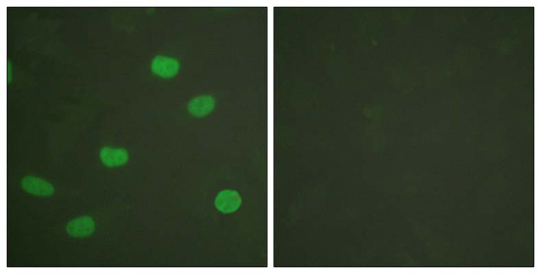 Lamin A/C (phospho Ser392) Rabbit Polyclonal Antibody | 兔多抗 | EnkiLife恩玑生命
