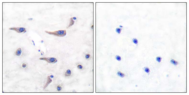MARCKS (phospho Ser163) Rabbit Polyclonal Antibody | 兔多抗 | EnkiLife恩玑生命