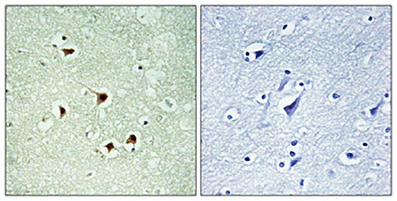 Max (phospho Ser2) Rabbit Polyclonal Antibody | 兔多抗 | EnkiLife恩玑生命