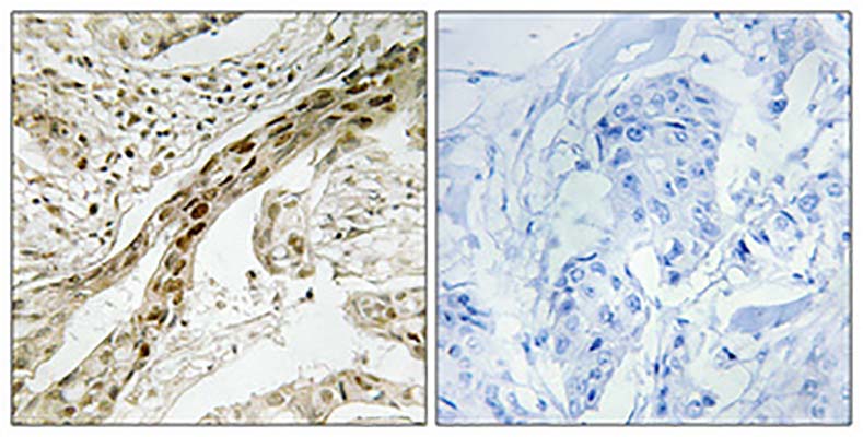 MEK-1 (phospho Thr292) Rabbit Polyclonal Antibody | 兔多抗 | EnkiLife恩玑生命