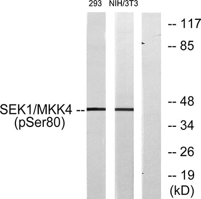 MEK-4 (phospho Ser80) Rabbit Polyclonal Antibody | 兔多抗 | EnkiLife恩玑生命