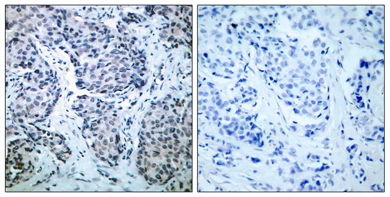 MEK-4 (phospho Thr261) Rabbit Polyclonal Antibody | 兔多抗 | EnkiLife恩玑生命