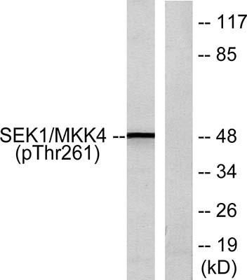MEK-4 (phospho Thr261) Rabbit Polyclonal Antibody | 兔多抗 | EnkiLife恩玑生命