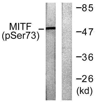 MITF (phospho Ser180) Rabbit Polyclonal Antibody | 兔多抗 | EnkiLife恩玑生命