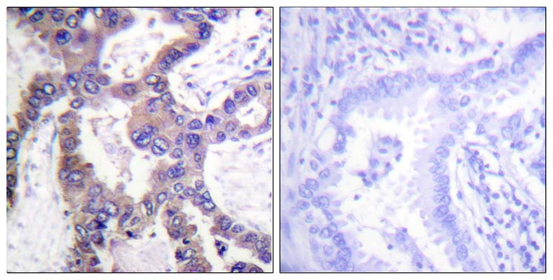 MKP-1 (phospho Ser359) Rabbit Polyclonal Antibody | 兔多抗 | EnkiLife恩玑生命