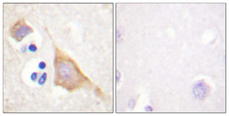 MOR-1 (phospho Ser375) Rabbit Polyclonal Antibody | 兔多抗 | EnkiLife恩玑生命