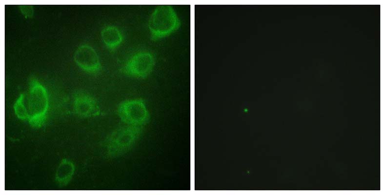 MRLC2 (phospho Ser18) Rabbit Polyclonal Antibody | 兔多抗 | EnkiLife恩玑生命