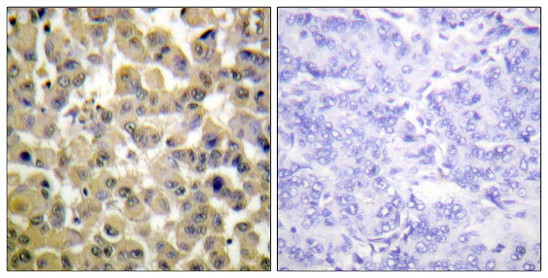 MSK1 (phospho Ser360) Rabbit Polyclonal Antibody | 兔多抗 | EnkiLife恩玑生命