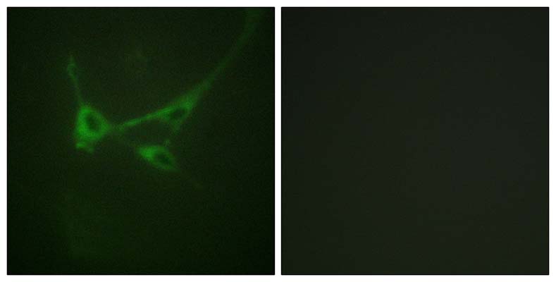 mTOR (phospho Ser2481) Rabbit Polyclonal Antibody | 兔多抗 | EnkiLife恩玑生命