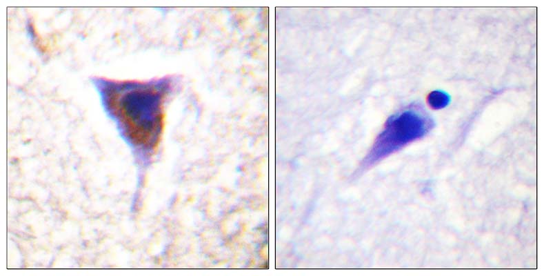 mTOR (phospho Ser2481) Rabbit Polyclonal Antibody | 兔多抗 | EnkiLife恩玑生命