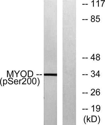 MyoD (phospho Ser200) Rabbit Polyclonal Antibody | 兔多抗 | EnkiLife恩玑生命