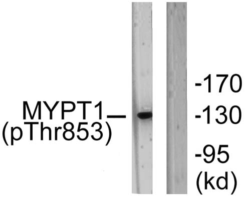 MYPT1 (phospho Thr853) Rabbit Polyclonal Antibody | 兔多抗 | EnkiLife恩玑生命