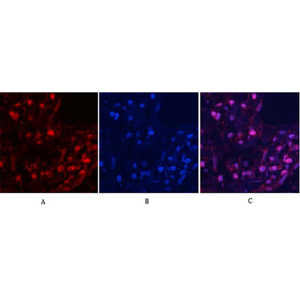 MYPT1 (phospho Thr853) Rabbit Polyclonal Antibody | 兔多抗 | EnkiLife恩玑生命