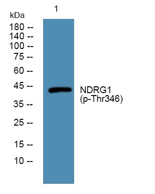 NDRG1 (phospho-Thr346)  Rabbit Polyclonal Antibody | 兔多抗 | EnkiLife恩玑生命