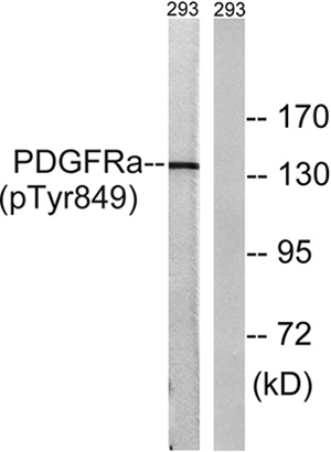 PDGFR-α (phospho Tyr849) Rabbit Polyclonal Antibody | 兔多抗 | EnkiLife恩玑生命