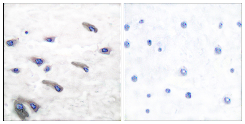 PDGFR-β (phospho Tyr751) Rabbit Polyclonal Antibody | 兔多抗 | EnkiLife恩玑生命