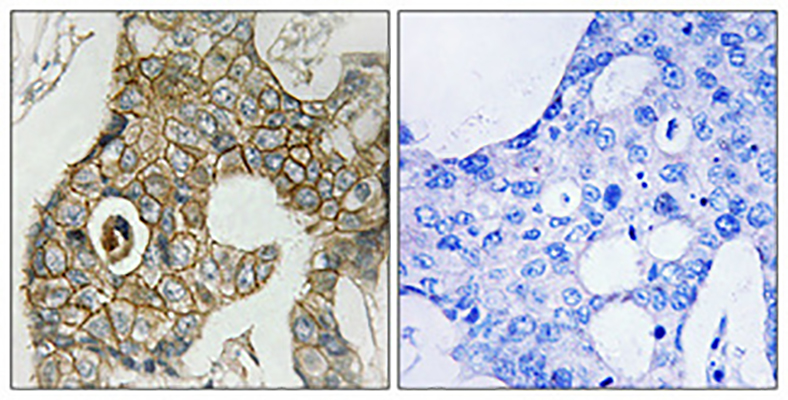 PDGFR-β (phospho Tyr751) Rabbit Polyclonal Antibody | 兔多抗 | EnkiLife恩玑生命