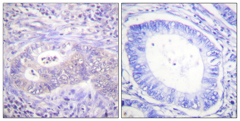 PFK-2 car (phospho Ser483) Rabbit Polyclonal Antibody | 兔多抗 | EnkiLife恩玑生命