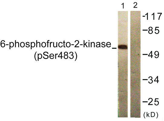 PFK-2 car (phospho Ser483) Rabbit Polyclonal Antibody | 兔多抗 | EnkiLife恩玑生命