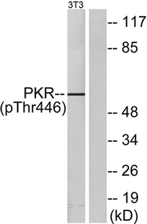 PKR (phospho Thr446) Rabbit Polyclonal Antibody | 兔多抗 | EnkiLife恩玑生命
