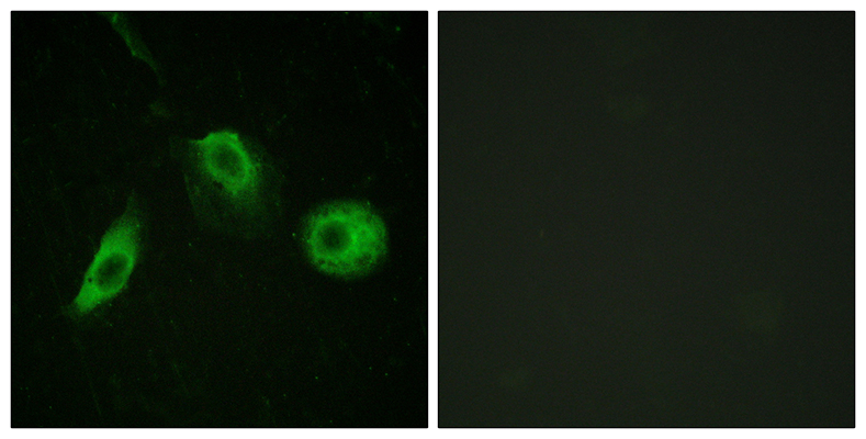 PLC γ2 (phospho Tyr1217) Rabbit Polyclonal Antibody | 兔多抗 | EnkiLife恩玑生命