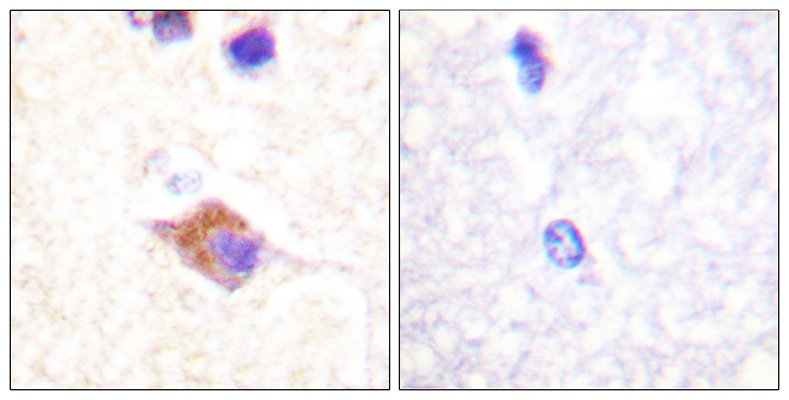 PLC γ2 (phospho Tyr1217) Rabbit Polyclonal Antibody | 兔多抗 | EnkiLife恩玑生命