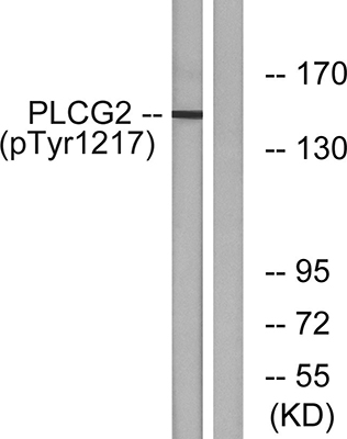 PLC γ2 (phospho Tyr1217) Rabbit Polyclonal Antibody | 兔多抗 | EnkiLife恩玑生命