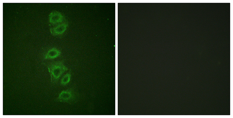 PP2A-Cα (phospho Tyr307) Rabbit Polyclonal Antibody | 兔多抗 | EnkiLife恩玑生命