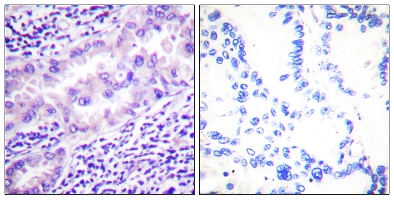PP2A-Cα (phospho Tyr307) Rabbit Polyclonal Antibody | 兔多抗 | EnkiLife恩玑生命