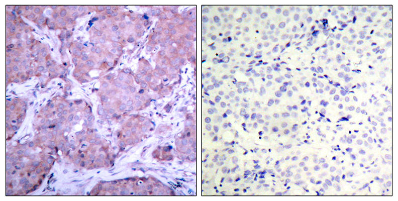 PTEN (phospho Ser380) Rabbit Polyclonal Antibody | 兔多抗 | EnkiLife恩玑生命