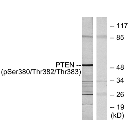 PTEN (phospho Ser380/T382/T383) Rabbit Polyclonal Antibody | 兔多抗 | EnkiLife恩玑生命