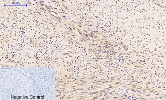 PTEN (phospho Ser380/T382/T383) Rabbit Polyclonal Antibody | 兔多抗 | EnkiLife恩玑生命